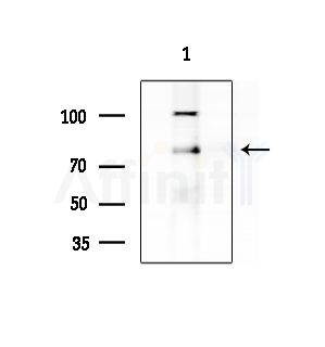 ATF6B Antibody - Western blot analysis of lysates from Hela cells(heat-shock treatment), using ATF6B Antibody at 1/1000 dilution.