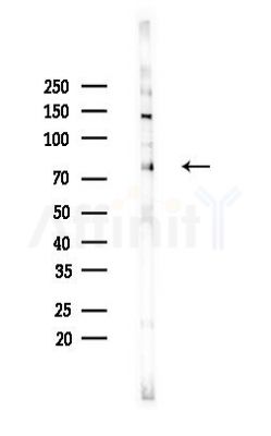ATF6B Antibody - Western blot analysis of lysates from Hela cells(heat-shock,45min treatment), using ATF6B Antibody at 1/1000 dilution.