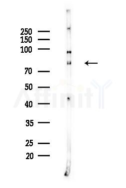 ATF6B Antibody - Western blot analysis of lysates from EC304 cells, using ATF6B Antibody at 1/1000 dilution.