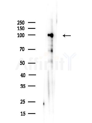 TACC1 Antibody - Western blot analysis of lysates from Rat lung, using TACC1 Antibody at 1/1000 dilution.