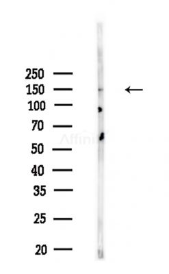 MAP3K6 Antibody - Western blot analysis of lysates from Rat brain, using MAP3K6 Antibody at 1/1000 dilution.