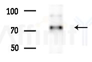 ES8L2 Antibody - Western blot analysis of extracts from A375 cells(heat-shock treatment), using ES8L2 Antibody at 1/1000 dilution.