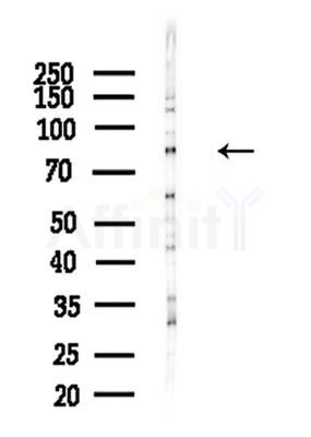 ES8L2 Antibody - Western blot analysis of lysates from A375 cells(heat-shock,45min treatment), using ES8L2 Antibody at 1/1000 dilution.