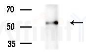 MUC13 Antibody - Western blot analysis of lysates from A375 cells(heat-shock treatment), using MUC13 Antibody at 1/1000 dilution.