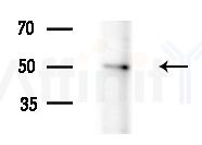 MUC13 Antibody - Western blot analysis of lysates from COLO205 cells(heat-shock treatment), using MUC13 Antibody at 1/1000 dilution.