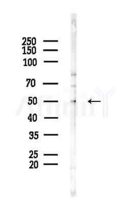 MUC13 Antibody - Western blot analysis of lysates from COLO205 cells(heat-shock,45min treatment), using MUC13 Antibody at 1/1000 dilution.