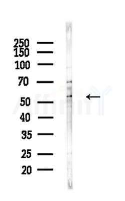 MUC13 Antibody - Western blot analysis of lysates from A375 cells(heat-shock,45min treatment), using MUC13 Antibody at 1/1000 dilution.