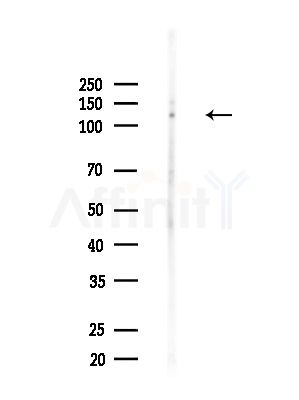 MN1 Antibody - Western blot analysis of lysates from Rat lung, using MN1 Antibody at 1/1000 dilution.