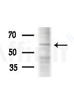 CYP26A1 Antibody - Western blot analysis of lysates from Mouse liver, using CYP26A1 Antibody at 1/1000 dilution.
