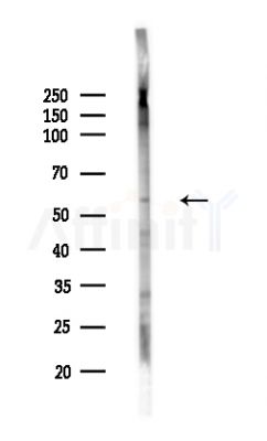 CYP26A1 Antibody - Western blot analysis of lysates from Mouse liver, using CYP26A1 Antibody at 1/1000 dilution.