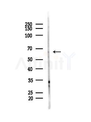 ELF1 Antibody - Western blot analysis of lysates from COLO205 cells(heat-shock,45min treatment), using ELF1 Antibody at 1/1000 dilution.