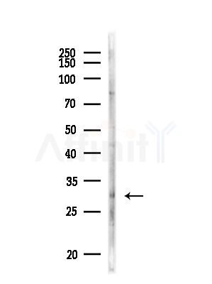LRAT Antibody - Western blot analysis of lysates from MDA-MB-231 cells(heat-shock,45min treatment), using LRAT Antibody at 1/1000 dilution.