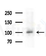 XRN2 Antibody - Western blot analysis of extracts from B16F10-LUC cells(UV,30min treatment), using XRN2 Antibody at 1/1000 dilution.