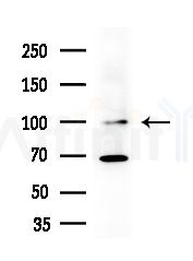XRN2 Antibody - Western blot analysis of extracts from Raji cells(heat-shock,45min treatment), using XRN2 Antibody at 1/1000 dilution.