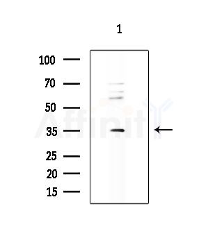 SUPT3H Antibody - Western blot analysis of extracts from Hela cells(heat-shock treatment), using SUPT3H Antibody at 1/1000 dilution.