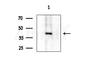 VPS72 Antibody - Western blot analysis of extracts from Mouse brain, using VPS72 Antibody at 1/1000 dilution.