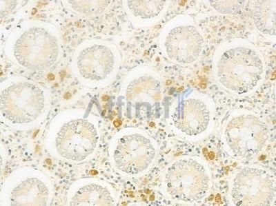 Collagen IV Antibody - AF0510 at 1/100 staining human normal colon tissue by IHC-P.