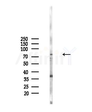 ZNF225 Antibody - Western blot analysis of lysates from A375 cells(starvation,24h treatment), using ZNF225 Antibody at 1/1000 dilution.
