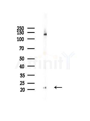 DIRA1 Antibody - Western blot analysis of lysates from RAW264.