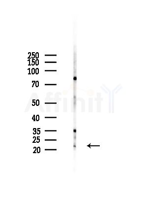 DIRA1 Antibody - Western blot analysis of lysates from HepG2 cells(LPS,4h treatment), using DIRA1 Antibody at 1/1000 dilution.
