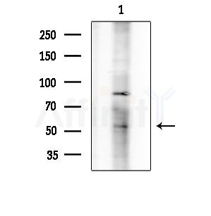 ADPGK Antibody - Western blot analysis of extracts from Hela cells(heat-shock treatment), using ADPGK Antibody at 1/1000 dilution.