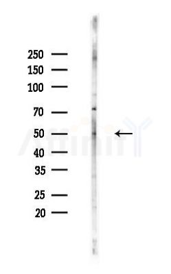 ADPGK Antibody - Western blot analysis of lysates from Hela cells(heat-shock,45min treatment), using ADPGK Antibody at 1/1000 dilution.