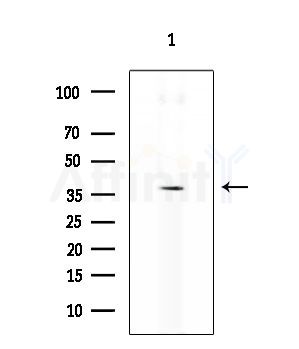 ACTG2 Antibody - Western blot analysis of lysates from Rat brain, using ACTG2 Antibody at 1/1000 dilution.