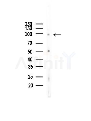 AKAP3 Antibody - Western blot analysis of lysates from COLO205 cells(UV,30min treatment), using AKAP3 Antibody at 1/1000 dilution.