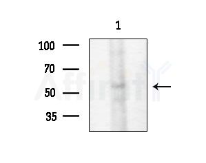 HNF4 alpha /gamma Antibody - Western blot analysis of lysates from Rat testis, using HNF4 alpha /gamma Antibody at 1/1000 dilution.