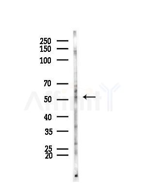 HNF4 alpha /gamma Antibody - Western blot analysis of lysates from COLO205 cells, using HNF4 alpha /gamma Antibody at 1/1000 dilution.
