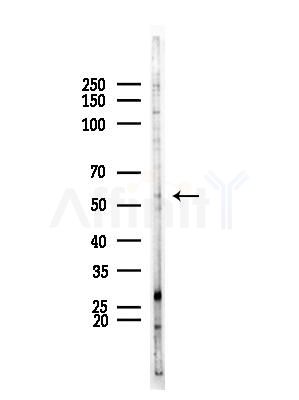 HNF4 alpha /gamma Antibody - Western blot analysis of lysates from EC304 cells, using HNF4 alpha /gamma Antibody at 1/1000 dilution.