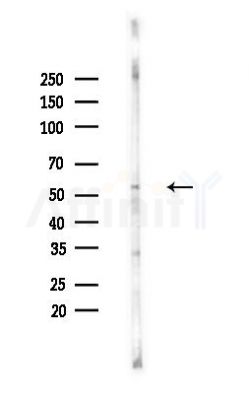 AP2 alpha/beta Antibody - Western blot analysis of lysates from Hela cells(heat-shock,45min treatment), using AP2 alpha/beta Antibody at 1/1000 dilution.