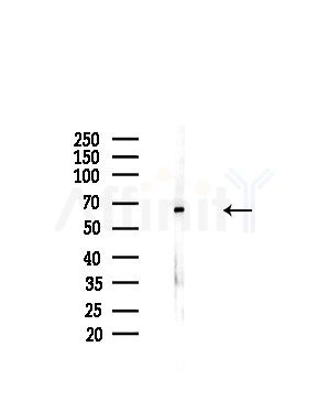 ADCK1 Antibody - Western blot analysis of lysates from A375 cells(starvation,24h treatment), using ADCK1 Antibody at 1/1000 dilution.