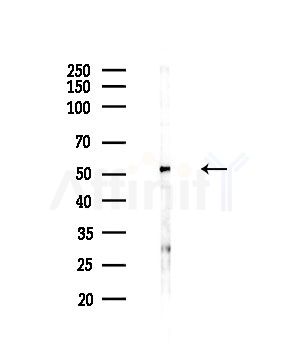 ADCK1 Antibody - Western blot analysis of lysates from HepG2 cells(LPS,4h treatment), using ADCK1 Antibody at 1/1000 dilution.