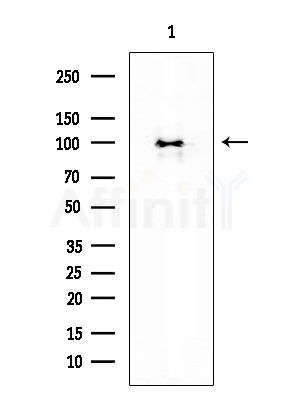 BCAR3 Antibody - Western blot analysis of extracts from EC304 cells, using BCAR3 Antibody at 1/1000 dilution.