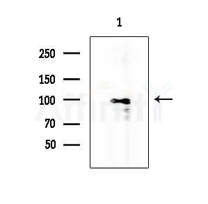 BCAR3 Antibody - Western blot analysis of extracts from Hela cells(heat-shock treatment), using BCAR3 Antibody at 1/1000 dilution.