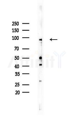 BCAR3 Antibody - Western blot analysis of lysates from EC304 cells, using BCAR3 Antibody at 1/1000 dilution.