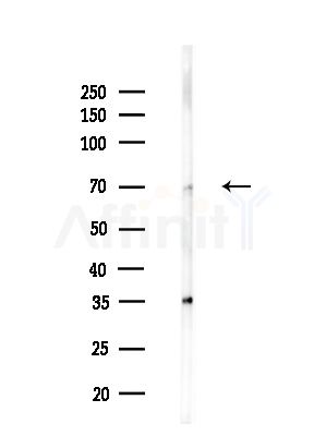 ZNF682 Antibody - Western blot analysis of lysates from B16F10-LUC cells(LPS,4h treatment), using ZNF682 Antibody at 1/1000 dilution.