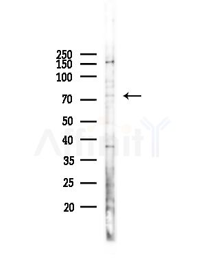 PIAS1 Antibody - Western blot analysis of lysates from Hela cells(heat-shock,45min treatment), using PIAS1 Antibody at 1/1000 dilution.