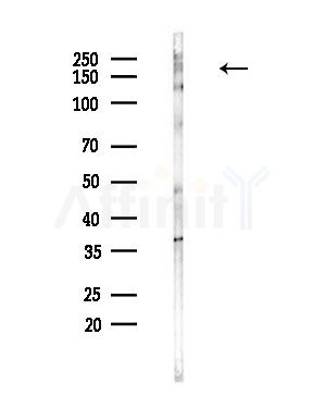 MAST2 Antibody - Western blot analysis of lysates from Mouse testis, using MAST2 Antibody at 1/1000 dilution.