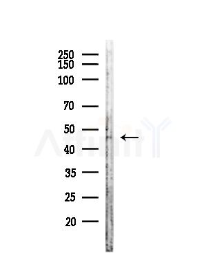 STRAD Antibody - Western blot analysis of lysates from Rat lung, using STRAD Antibody at 1/1000 dilution.