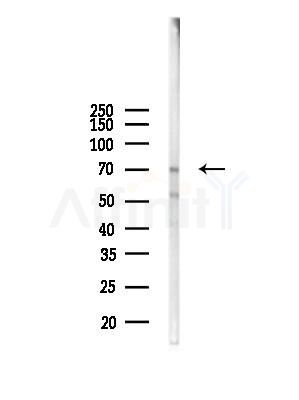 ZNF337 Antibody - Western blot analysis of lysates from Rat liver, using ZNF337 Antibody at 1/1000 dilution.