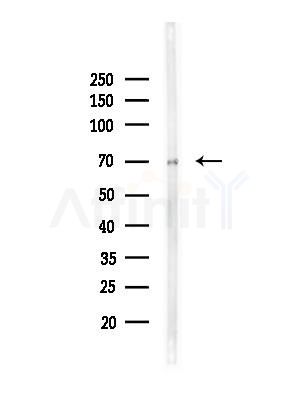 ZNF337 Antibody - Western blot analysis of lysates from Hela cells(heat-shock,45min treatment), using ZNF337 Antibody at 1/1000 dilution.