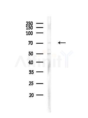 ZNF337 Antibody - Western blot analysis of lysates from HepG2 cells(heat-shock,45min treatment), using ZNF337 Antibody at 1/1000 dilution.