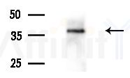 MAGE 1 Antibody - Western blot analysis of lysates from COLO205 cells(heat-shock treatment), using MAGE 1 Antibody at 1/1000 dilution.