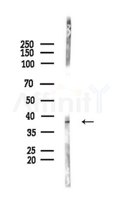 MAGE 1 Antibody - Western blot analysis of lysates from COLO205 cells(heat-shock,45min treatment), using MAGE 1 Antibody at 1/1000 dilution.