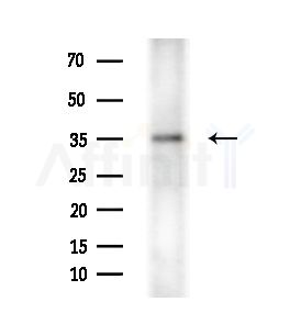 TUSC3 Antibody - Western blot analysis of extracts from Mouse liver, using TUSC3 Antibody at 1/1000 dilution.