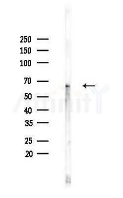 TF2H2 Antibody - Western blot analysis of lysates from Hela cells(heat-shock,45min treatment), using TF2H2 Antibody at 1/1000 dilution.