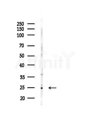 NRIP2 Antibody - Western blot analysis of lysates from A375 cells(LPS, 4h treatment), using NRIP2 Antibody at 1/1000 dilution.