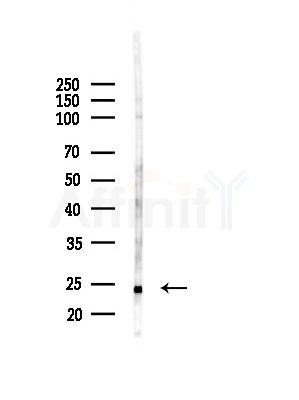 NRIP2 Antibody - Western blot analysis of lysates from RAW264.